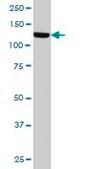 Monoclonal Anti-TAOK1 antibody produced in mouse clone 4E12, purified immunoglobulin, buffered aqueous solution