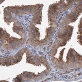 抗-LRBA 兔抗 Prestige Antibodies&#174; Powered by Atlas Antibodies, affinity isolated antibody, buffered aqueous glycerol solution, Ab2