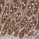 抗-C1orf109 兔抗 Prestige Antibodies&#174; Powered by Atlas Antibodies, affinity isolated antibody, buffered aqueous glycerol solution