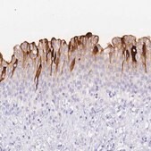 Anti-UPK1A antibody produced in rabbit Prestige Antibodies® Powered by Atlas Antibodies, affinity isolated antibody, buffered aqueous glycerol solution
