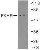 Anti-FKHR antibody produced in rabbit affinity isolated antibody