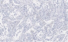 Anti-Nectin-2/CD112 Antibody, clone 2H6 ZooMAb® Rabbit Monoclonal recombinant, expressed in HEK 293 cells