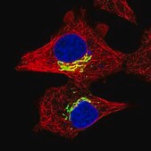 Anti-RFK antibody produced in rabbit Prestige Antibodies&#174; Powered by Atlas Antibodies, affinity isolated antibody, buffered aqueous glycerol solution