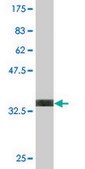 Monoclonal Anti-DLX6 antibody produced in mouse clone 2D7, purified immunoglobulin, buffered aqueous solution