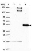 Anti-BEND5 antibody produced in rabbit Prestige Antibodies&#174; Powered by Atlas Antibodies, affinity isolated antibody, buffered aqueous glycerol solution
