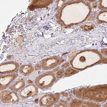 Anti-ZNF33A antibody produced in rabbit Prestige Antibodies&#174; Powered by Atlas Antibodies, affinity isolated antibody, buffered aqueous glycerol solution