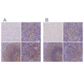 Anti-CD40 antibody produced in rabbit Prestige Antibodies® Powered by Atlas Antibodies, affinity isolated antibody, buffered aqueous glycerol solution