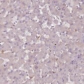 Anti-CC2D2B antibody produced in rabbit Prestige Antibodies® Powered by Atlas Antibodies, affinity isolated antibody, buffered aqueous glycerol solution