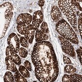 Anti-VSIG1 antibody produced in rabbit Prestige Antibodies&#174; Powered by Atlas Antibodies, affinity isolated antibody, buffered aqueous glycerol solution