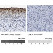 Anti-UPK3A antibody produced in rabbit Prestige Antibodies&#174; Powered by Atlas Antibodies, affinity isolated antibody, buffered aqueous glycerol solution, Ab3