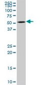 Anti-KATNA1 antibody produced in mouse IgG fraction of antiserum, buffered aqueous solution