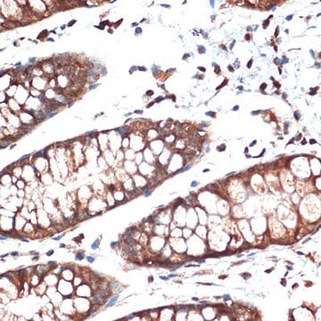 Anti-STK39 antibody produced in rabbit