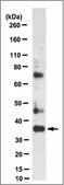 Anti-FBPase 1, clone 13A8.1 Antibody clone 13A8.1, from mouse