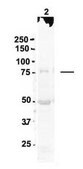 Anti-DNM1L, (N-terminal) antibody produced in rabbit affinity isolated antibody