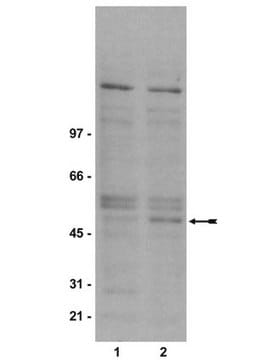 抗磷酸化-GSK3&#946;（Ser9）抗体，克隆2D3 clone 2D3, Upstate&#174;, from mouse