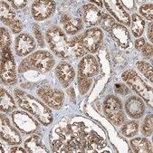 Anti-ITM2B antibody produced in rabbit Prestige Antibodies&#174; Powered by Atlas Antibodies, affinity isolated antibody, buffered aqueous glycerol solution