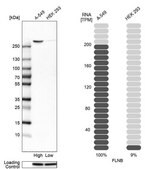 Anti-FLNB antibody produced in rabbit Prestige Antibodies&#174; Powered by Atlas Antibodies, affinity isolated antibody, buffered aqueous glycerol solution