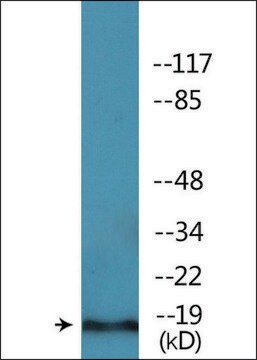 Anti-phospho-PEA-15 (pSer104) antibody produced in rabbit affinity isolated antibody