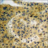 Anti-phospho-IKK-α (pSer176) /IKK-β (pSer177) antibody produced in rabbit affinity isolated antibody