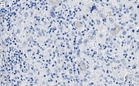Anti-p-ATF-2-Thr69/71 Antibody, clone 1H23 ZooMAb&#174; Rabbit Monoclonal recombinant, expressed in HEK 293 cells