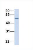 Anti-TMEM161A antibody produced in rabbit affinity isolated antibody