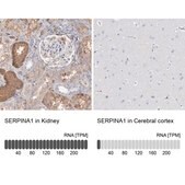 Anti-SERPINA1 antibody produced in rabbit Prestige Antibodies® Powered by Atlas Antibodies, affinity isolated antibody, buffered aqueous glycerol solution