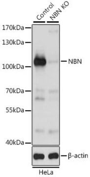 Anti-NBN antibody produced in rabbit