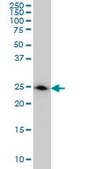 Monoclonal Anti-DCXR antibody produced in mouse clone 6A6, purified immunoglobulin, buffered aqueous solution