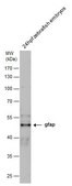 Anti-Gfap antibody produced in rabbit affinity isolated antibody