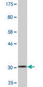 Monoclonal Anti-S100P antibody produced in mouse clone 1A11, purified immunoglobulin, buffered aqueous solution