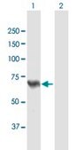 Anti-ACSL5 antibody produced in mouse purified immunoglobulin, buffered aqueous solution
