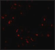 Anti-LIS1 antibody produced in rabbit affinity isolated antibody, buffered aqueous solution