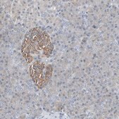 Anti-GBA antibody produced in rabbit Prestige Antibodies® Powered by Atlas Antibodies, affinity isolated antibody, buffered aqueous glycerol solution