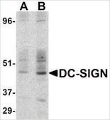 Anti-DC-SIGN (ab1) antibody produced in rabbit affinity isolated antibody, buffered aqueous solution