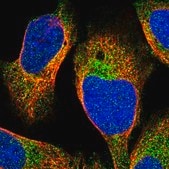 Anti-CHKB antibody produced in rabbit Prestige Antibodies&#174; Powered by Atlas Antibodies, affinity isolated antibody, buffered aqueous glycerol solution