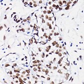 Anti-Acetyl-Histone H4-K8 antibody produced in rabbit