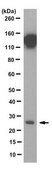 Anti-C-Reactive Protein Antibody, clone 2A8.1 clone 2A8.1, from mouse