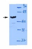 Anti-PAX2 IgG fraction of antiserum
