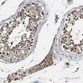 Anti-RHOT2 antibody produced in rabbit Prestige Antibodies&#174; Powered by Atlas Antibodies, affinity isolated antibody, buffered aqueous glycerol solution