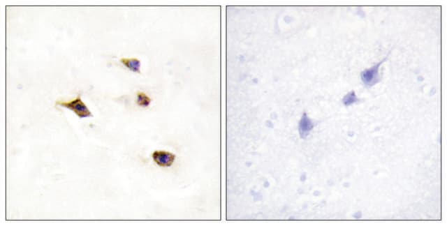 Anti-IP6K3 antibody produced in rabbit affinity isolated antibody