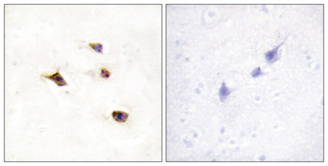 Anti-IP6K3 antibody produced in rabbit affinity isolated antibody