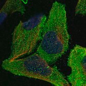 Anti-EIF2B3 antibody produced in rabbit Prestige Antibodies&#174; Powered by Atlas Antibodies, affinity isolated antibody, buffered aqueous glycerol solution, Ab1