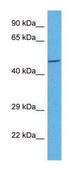 Anti-CYTB (C-terminal) antibody produced in rabbit affinity isolated antibody