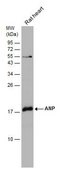 Anti-NPPA antibody produced in rabbit affinity isolated antibody, buffered aqueous solution