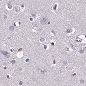 Anti-RP1L1 antibody produced in rabbit Prestige Antibodies&#174; Powered by Atlas Antibodies, affinity isolated antibody