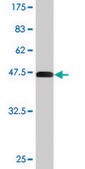 Monoclonal Anti-CTGF antibody produced in mouse clone 2C11, purified immunoglobulin, buffered aqueous solution