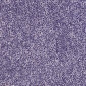 Anti-TRPM1 antibody produced in rabbit Prestige Antibodies&#174; Powered by Atlas Antibodies, affinity isolated antibody