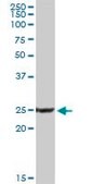 Anti-PPP3R1 antibody produced in rabbit purified immunoglobulin, buffered aqueous solution