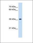 Anti-MAS1 (AB1) antibody produced in rabbit affinity isolated antibody