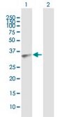 Anti-AKR7A3 antibody produced in mouse IgG fraction of antiserum, buffered aqueous solution